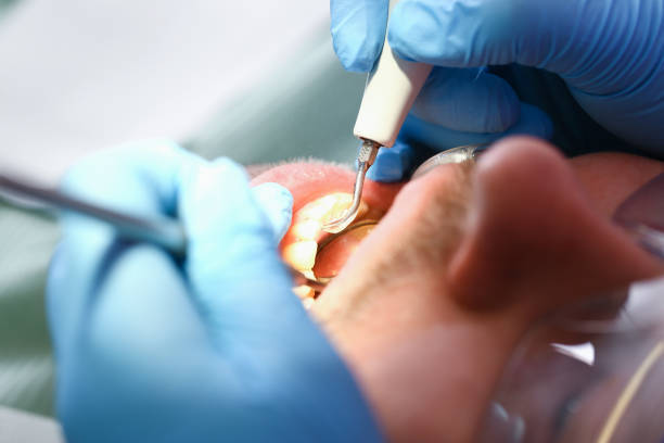 Professional Emergency Dental Service in LA